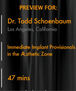 Immediate Implant Provisionals in the Aesthetic Zone