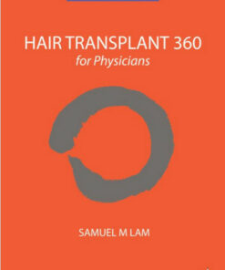 Hair Transplant 360 for Physicians 2  Edition