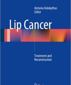 Lip Cancer: Treatment and Reconstruction 2014th Edition