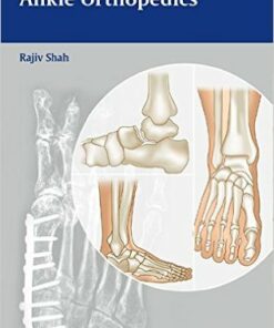 Handbook of Foot and Ankle Orthopedics 1st Edition
