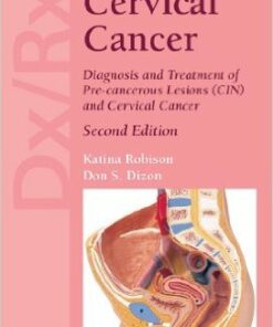 Dx/Rx: Cervical Cancer 2nd Edition
