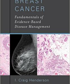 Breast Cancer: Fundamentals of Evidence-Based Disease Management 1st Edition