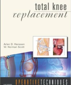 Operative Techniques: Total Knee Replacement 1e