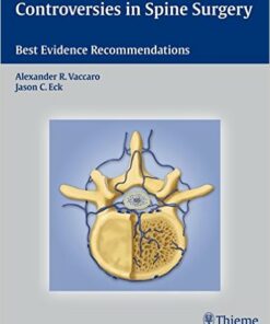 Controversies in Spine Surgery: Best Evidence Recommendations 1st Edition
