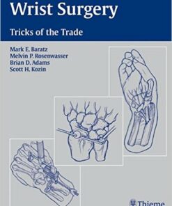 Wrist Surgery: Tricks of the Trade 1st Edition