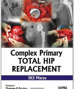 Complex Primary Total Hip Replacement 1st Edition