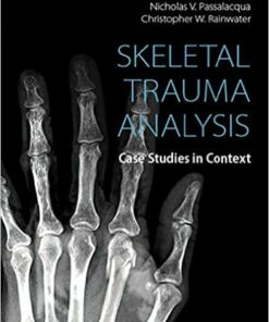 Skeletal Trauma Analysis: Case Studies in Context 1st Editionv