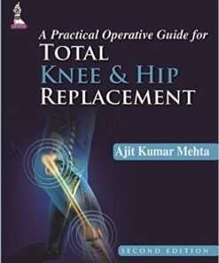 A Practical Operative Guide for Total Knee and Hip Replacement 2nd Edition