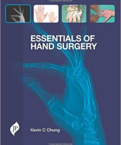 Essentials of Hand Surgery 1st Edition