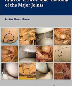 Atlas of Arthroscopic Anatomy of Major Joints 1st Edition