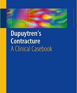 Dupuytren's Contracture: A Clinical Casebook 1st ed. 2016 Edition