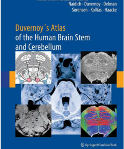 Duvernoy's Atlas of the Human Brain Stem and Cerebellum: High-Field MRI, Surface Anatomy, Internal Structure, Vascularization and 3 D Sectional Anatomy 1st Edition