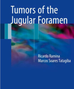 Tumors of the Jugular Foramen 1st ed. 2017 Edition PDF