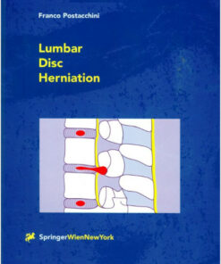 Lumbar Disc Herniation 1999th Edition
