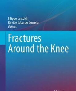 Fractures Around the Knee 2016