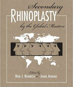 Secondary Rhinoplasty by the Global Masters 1st Edition PDF ORIGINAL + Video