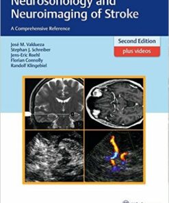 Neurosonology and Neuroimaging of Stroke : A Comprehensive Reference 2nd edition – Original PDF + (129 VIDEOS+ 8 Additional Files)​