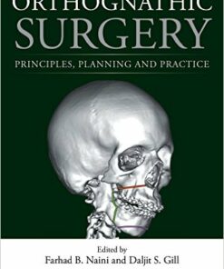 Orthognathic Surgery: Principles, Planning and Practice 1st Edition