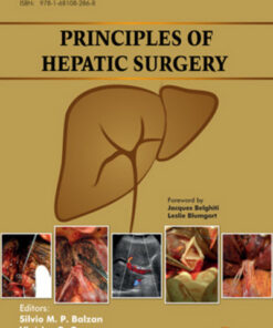 Principles of Hepatic Surgery