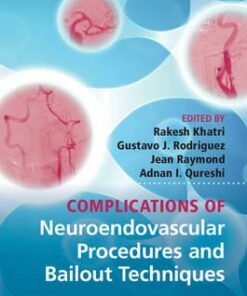Complications of Neuroendovascular Procedures and Bailout Techniques