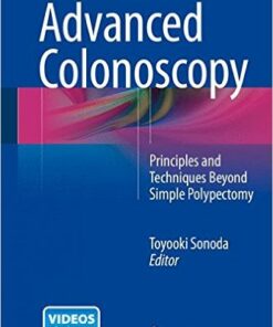 Advanced Colonoscopy: Principles and Techniques Beyond Simple Polypectomy 2014th Edition