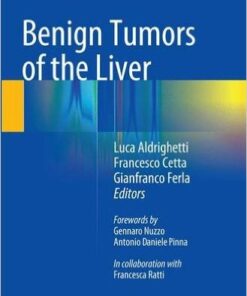 Benign Tumors of the Liver  1st ed. 2015 Edition