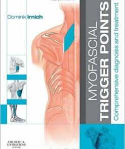 Myofascial Trigger Points: Comprehensive diagnosis and treatment, 1e 1st Edition