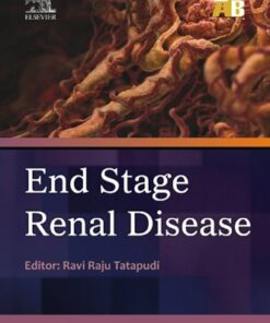 End Stage Renal Disease - ECAB