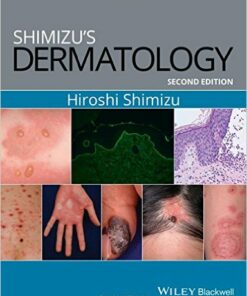 Shimizu's Dermatology 2nd Edition PDF