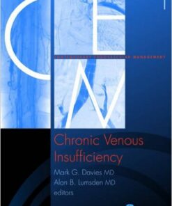 Chronic Venous Insufficiency: Volume 1 of Contemporary Endovascular Management Series 1st Edition