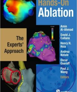 Hands-on Ablation: The Experts' Approach 1st Edition