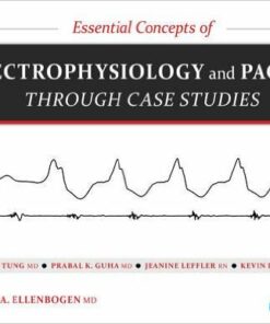 Essential Concepts of Electrophysiology and Pacing through Case Studies