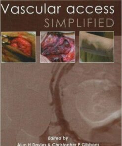 Vascular Access Simplified Edition 2