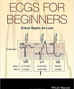 ECGs for Beginners