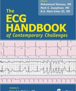 The ECG Handbook of Contemporary Challenges