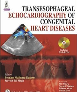 Transesophageal Echocardiography of Congenital Heart Diseases