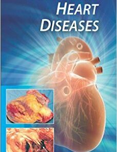 Manual of Coronary Heart Diseases
