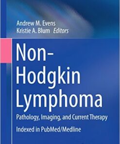 Non-Hodgkin Lymphoma