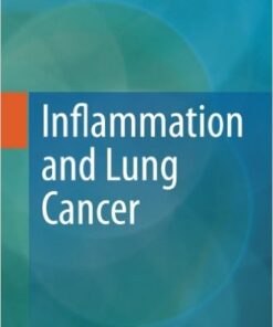 Inflammation and Lung Cancer