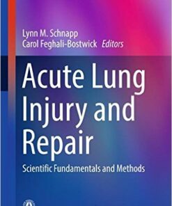 Acute Lung Injury and Repair 2017 : Scientific Fundamentals and Methods