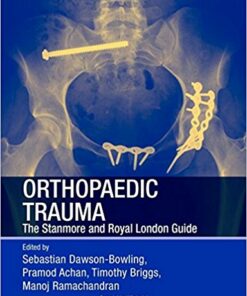 Orthopaedic Trauma: The Stanmore and Royal London Guide