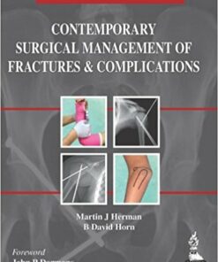 Contemporary Surgical Management of Fractures and Complications: Pediatrics (Volume 3)