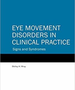 Eye Movement Disorders in Clinical Practice: Signs and Syndromes