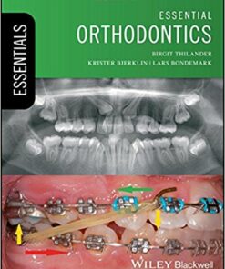 Essential Orthodontics (Essentials (Dentistry)) 1st Edition PDF
