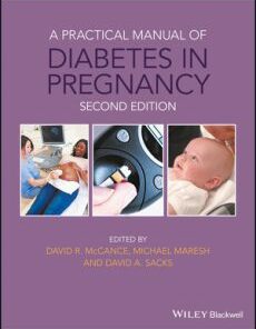 A Practical Manual of Diabetic Retinopathy Management 2nd Edition PDF
