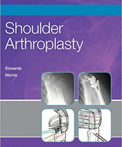 Shoulder Arthroplasty 2nd Edition PDF & Video
