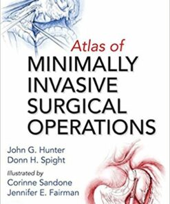 Atlas of Minimally Invasive Surgical Operations 1st Edition PDF