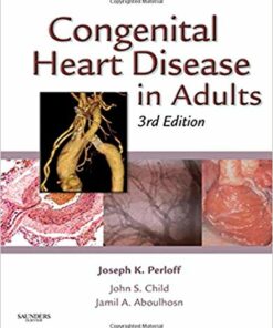 Congenital Heart Disease in Adults (Congenital Heart Disease in Adults (Perloff/Child)) 3rd Edition Epub