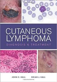 Cutaneous Lymphoma: Diagnosis and Treatment 1st Edition PDF
