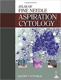 Atlas of Fine Needle Aspiration Cytology 1st Edition PDF